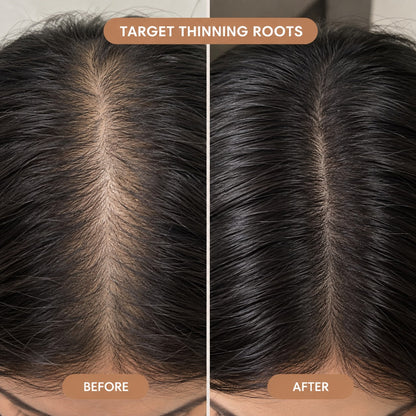 ZORVIA™ Crystal Serum Comb