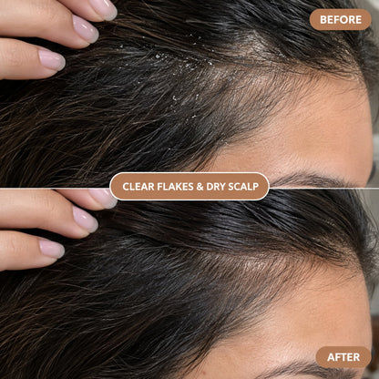 ZORVIA™ Crystal Serum Comb