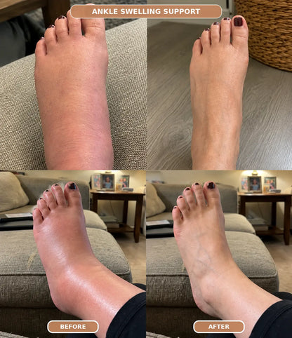 Elvarique Compression Socks